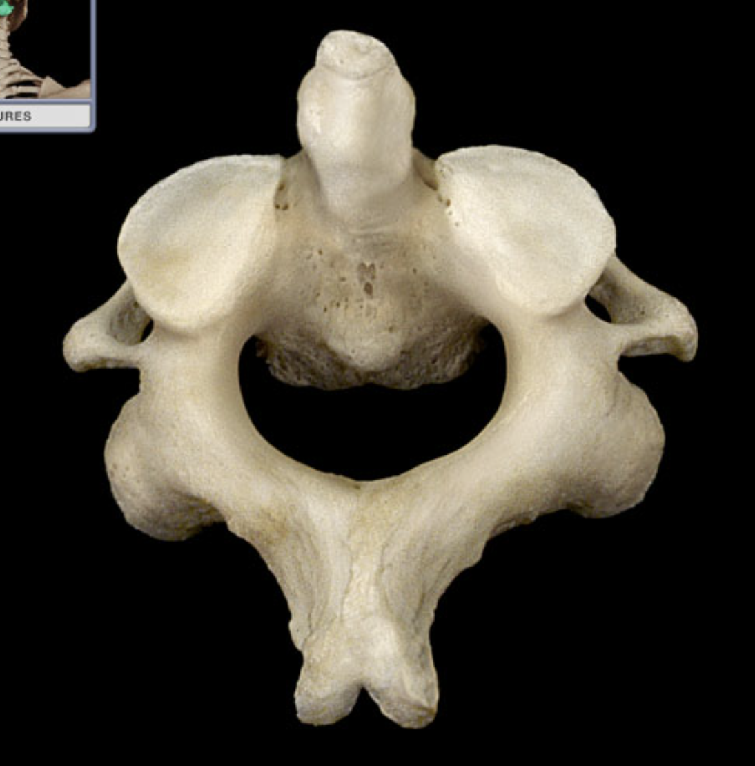 <p>Name this vertebra</p>