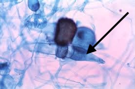 <p>What cell is the arrow pointing at?</p>