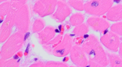 <p>What muscle type is this?</p>