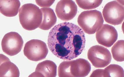 <p>Characteristics of Neutrophils  &nbsp;</p>