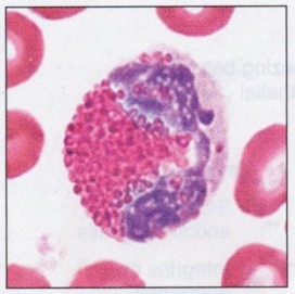 <p>Characterized by an irregularly shaped nucleus partially contricted into two lobes, somewhat larger than neutrophils; cytoplasm is filled w/ coarse, round uniformly-sized red-orange granules</p>