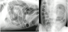 <p>Is this functional/mechanical ileus?</p>