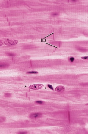 <p>What type of muscle is this?</p>