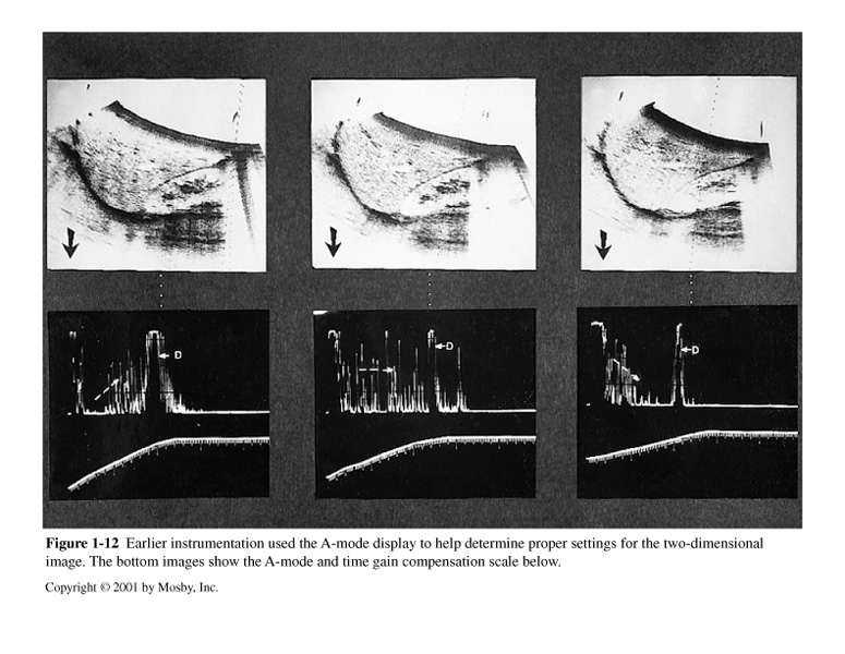 <p>What does these image describes?</p>
