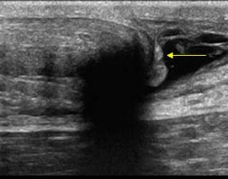 <p>Identify this image.</p>