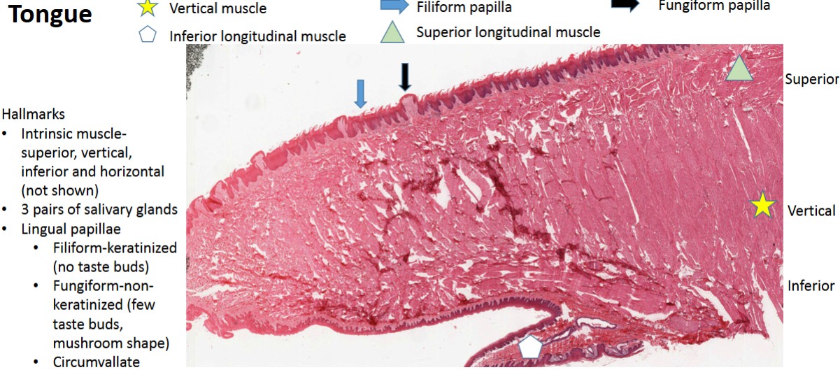 <p>Hallmarks</p><p>• Intrinsic muscle-</p><p>superior, vertical,</p><p>inferior and horizontal</p><p>(not shown)</p><p>• 3 pairs of salivary glands</p><p>• Lingual papillae</p><p>• Filiform-keratinized</p><p>(no taste buds)</p><p>• Fungiform-non-</p><p>keratinized (few</p><p>taste buds,</p><p>mushroom shape)</p><p>• Circumvallate</p>