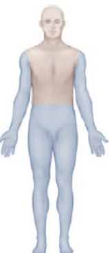 <p>Paralysis of all four extremities. This is also called tetraplegia.</p>