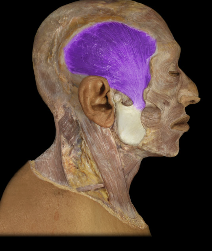 <p>origin: the temporal fossa originates and the deep surface of the temporal fascia insertion: apex and medial surface of the coronoid process of the mandible</p>