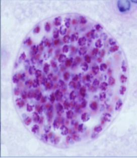 <ul><li><p>tissue cyst of Toxoplasma gondii</p></li><li><p><span>asymptomatic phase of toxoplasmosis</span></p></li></ul><p></p>