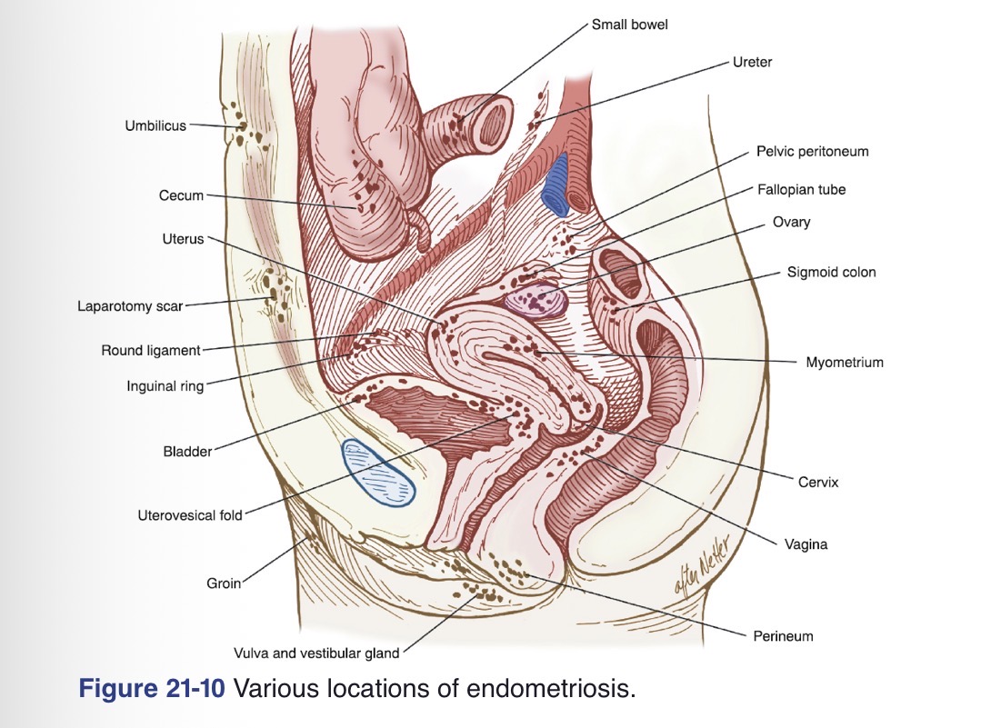 <p>Ovaries </p>