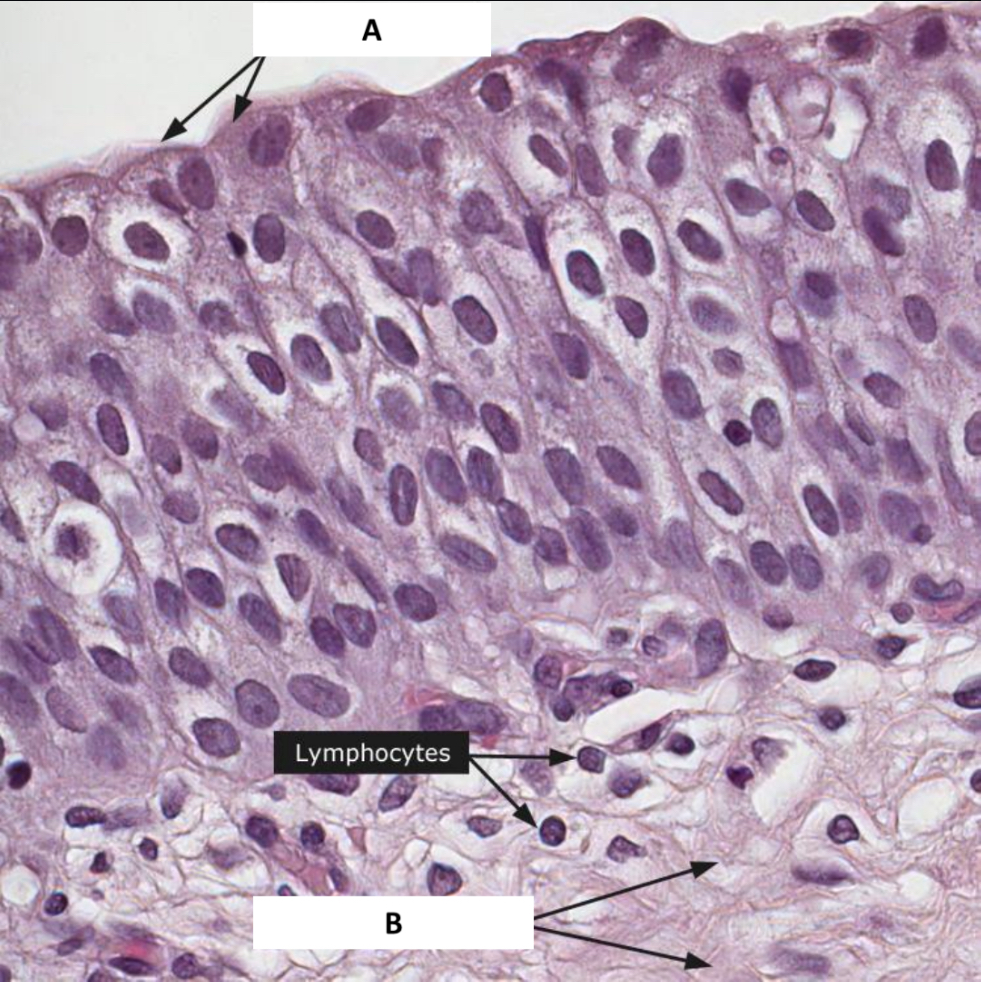 <p>Name the structure indicated by A.</p>