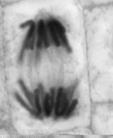 <p>what is this plant cell going through? </p>