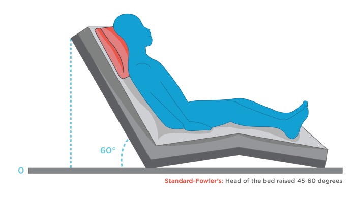 <p>a semi-sitting position; the head of the bed is raised between 45 and 60 degrees</p>
