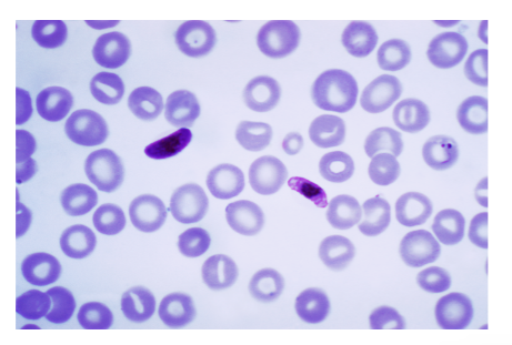 <p>-Only ring forms and gametocytes seen in blood</p><p>-Small, delicate ring forms</p><ul><li><p>Applique forms</p></li><li><p>Multiple infections</p></li><li><p>Multiple chromatin dots</p></li></ul><p>-Gametocyte = banana shaped</p><p></p>