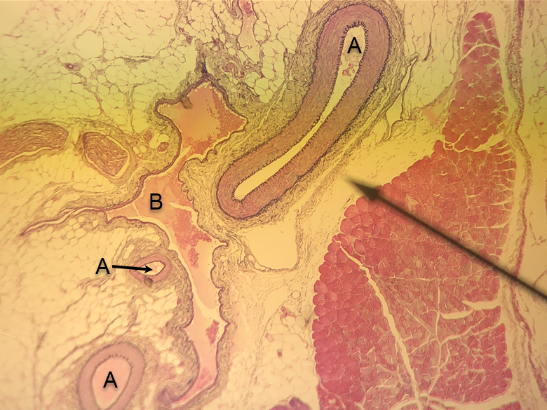 <p>In the image above, identify the formed elements at the tip of the pointer</p>