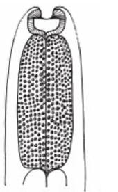 <ul><li><p>muscular <strong><em>anteriorly</em></strong>,</p></li><li><p>glandular <strong><em>posteriorly</em></strong>,</p></li><li><p>like in <strong>filariids and spirurids</strong></p></li><li><p>present in families under</p></li><li><p><strong>Order Spirurida</strong></p></li><li><p><strong>Superfamily Spiruroidea</strong></p></li><li><p>-<span style="font-family: "Times New Roman"; line-height: normal; font-size: 7pt;"> &nbsp; </span>Family Acuriidae</p><ul><li><p>Family Acuriidae</p></li><li><p>Family Dracunculidae</p></li></ul><ul><li><p class="MsoListParagraphCxSpMiddle">Family Filariidae</p></li><li><p class="MsoListParagraphCxSpMiddle">Family Gnathostomatidae</p></li><li><p class="MsoListParagraphCxSpMiddle">Family Onchoceradae</p></li></ul></li></ul><ul><li><p class="MsoListParagraphCxSpMiddle">Family Physalopteriidae</p></li><li><p class="MsoListParagraphCxSpMiddle">Family Steriidae</p></li><li><p class="MsoListParagraphCxSpMiddle">Family Spiruridae</p></li><li><p class="MsoListParagraphCxSpMiddle">Family Thelaziidae</p></li><li><p class="MsoListParagraphCxSpMiddle">Family Tetrameridae</p></li></ul><p></p>