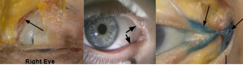 <p>Left:</p><p>middle arrows</p><p>Last image arrows (left and right)</p><p></p>