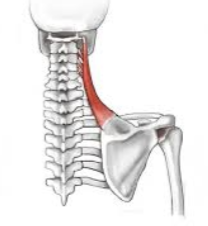 <p>What muscle is this? </p>