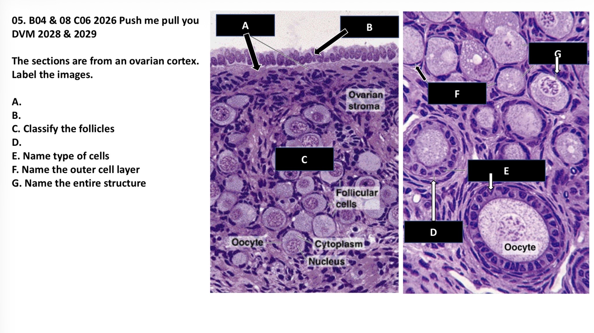 <p>The sections are from an ovarian cortex. Label the images. </p><p>A. </p><p>B. </p><p>C. Classify the follicles </p><p>D. </p><p>E. Name the type of cells </p><p>F. Name the outer cell layer </p><p>G. Name the entire structure </p>