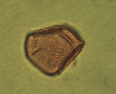 <p>Identify the pollen grains to the <strong>Family </strong>level</p>