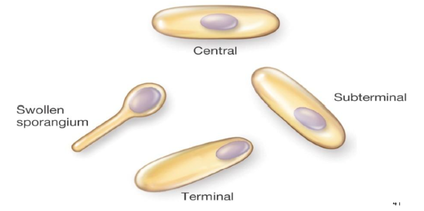 <p>endospore</p>
