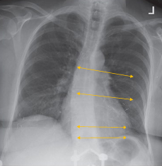 <p>what does this patient have?</p>