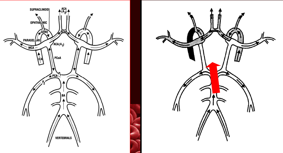 <ul><li><p>posterior to anterior collateral through posterior communicating artery </p></li><li><p>external carotid to internal carotid thorugh reversed opthalmic artery</p></li><li><p>crossover collateralization through ACA </p></li></ul><p></p>