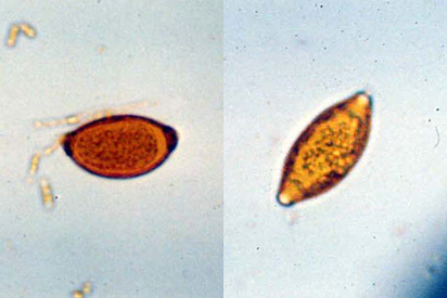 <p></p><ul><li><p>smaller egg, more oval, and less symmetrical than the whipworm (Trichuris vulpis)</p></li><li><p>has rough, pitted shell</p></li></ul><p></p>