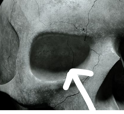 <p>This part of the skull is referred to as the: </p>