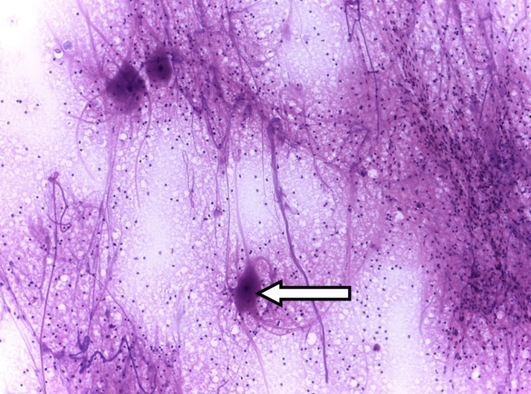 <p>What is the arrow pointing to?</p>