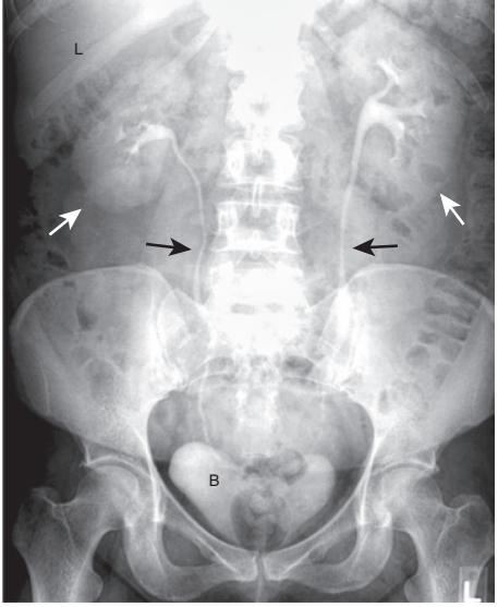 <p>Black arrows are the?</p>