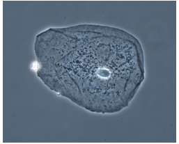 <p>Enhances tiny differences b/w cell and its background</p><ul><li><p>best for LIVE cells (no staining needed)</p></li><li><p>can look at motility + internal structures</p></li><li><p>more specialized than brightfield</p></li></ul><p></p>