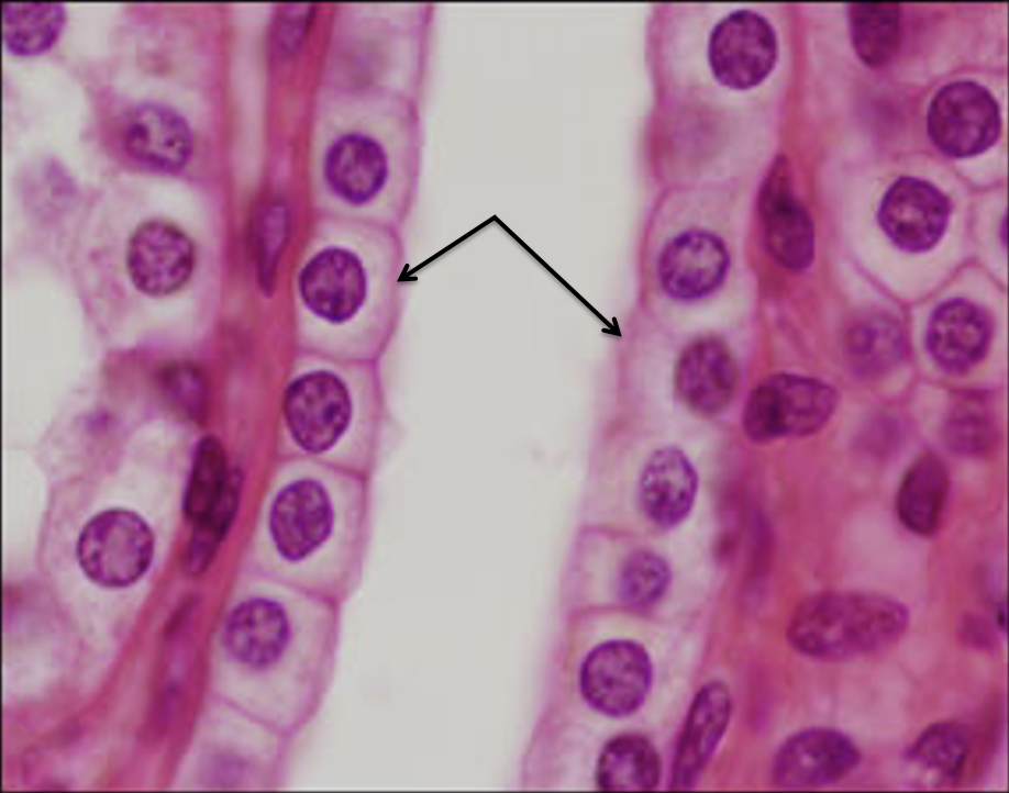 <p>Identify this epithelium.</p>