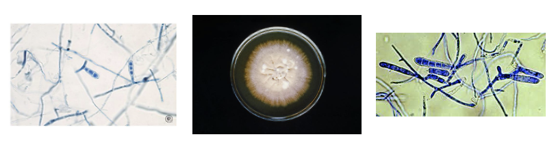 <p>ID this mold </p>