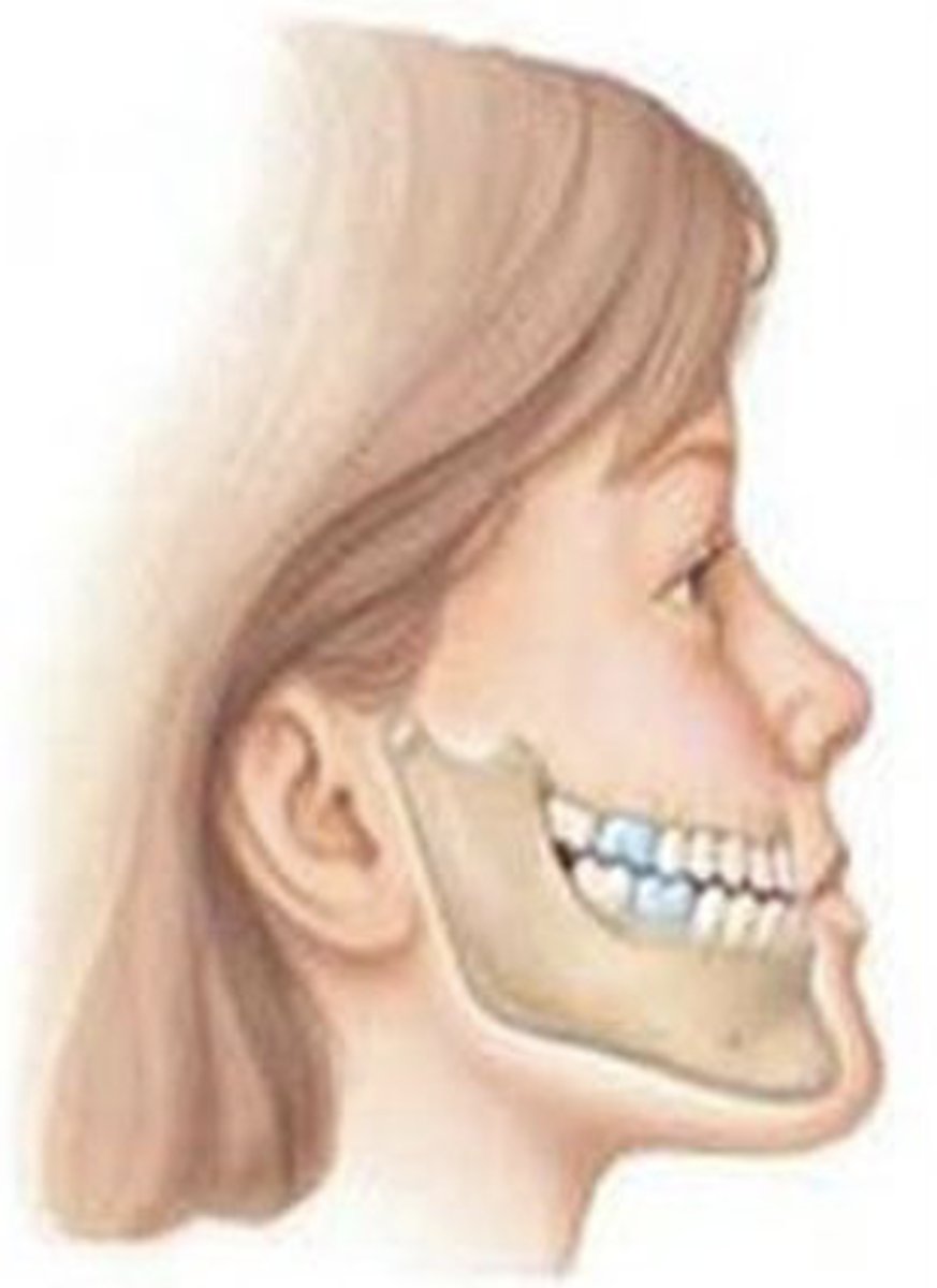 <p>ID the occlusal classification:</p>