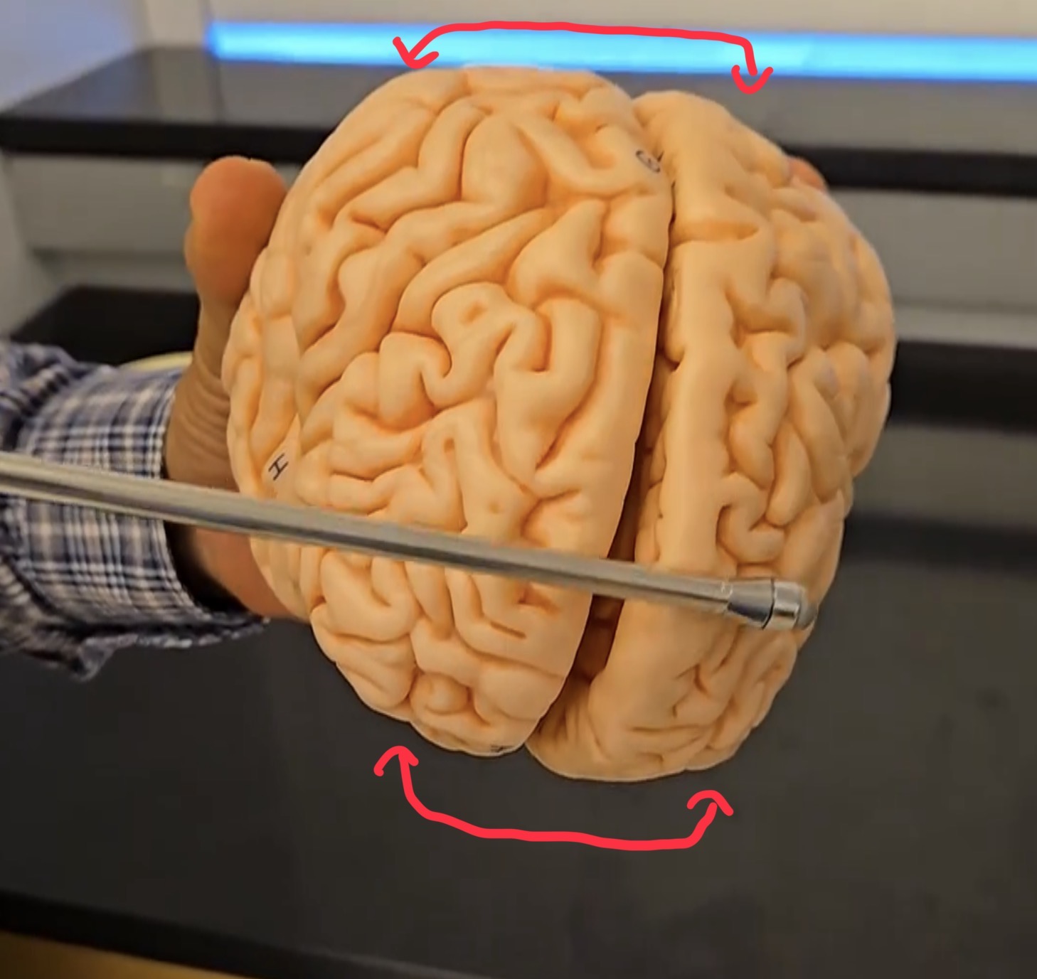 <p>Cerebrum.</p>