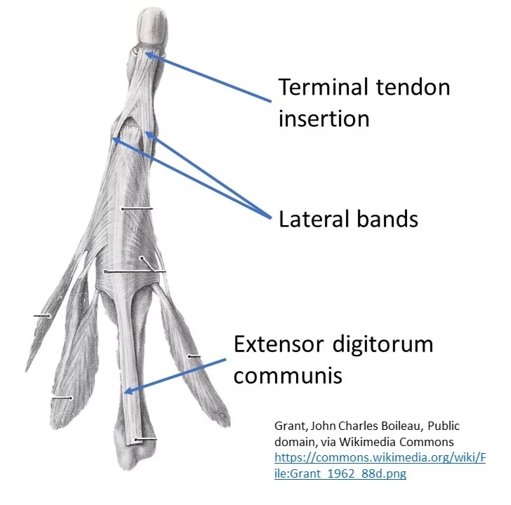 <p><strong>DIP Joint</strong>: Terminal Tendon</p>