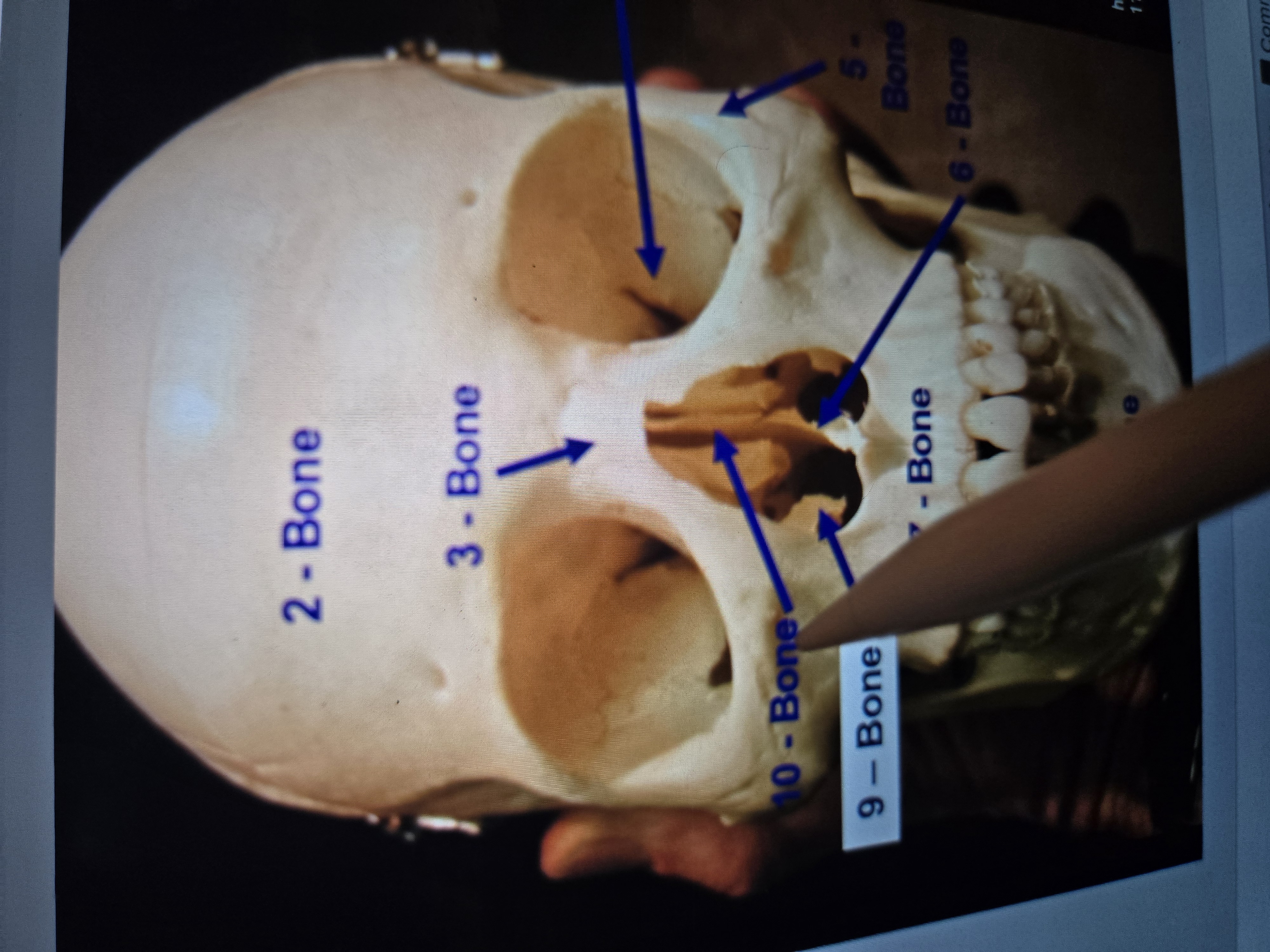 term image