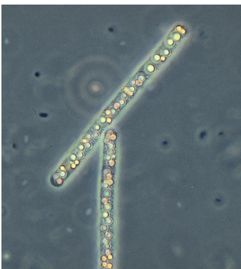 <p>Beggiatoa, a bacterium that lives in sulfurous environments, oxidizes H2S to produce sulfur and can fix carbon even in the dark. In this light micrograph, yellow deposits of sulfur can be seem inside two of these bacterial cells. </p>