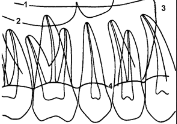 <p>Hvad viser 1?</p>