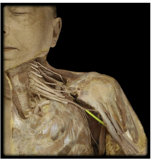 <p>What’s the spinal level of the Radial nerve?</p>