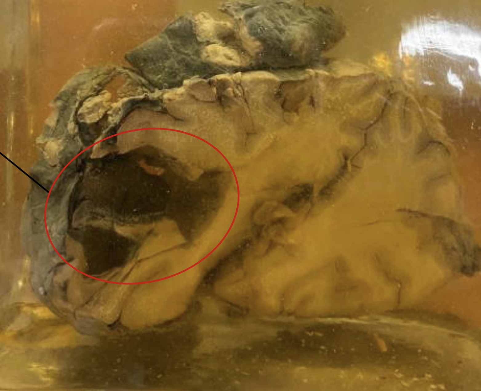 <p>Identify and type of necrosis</p>