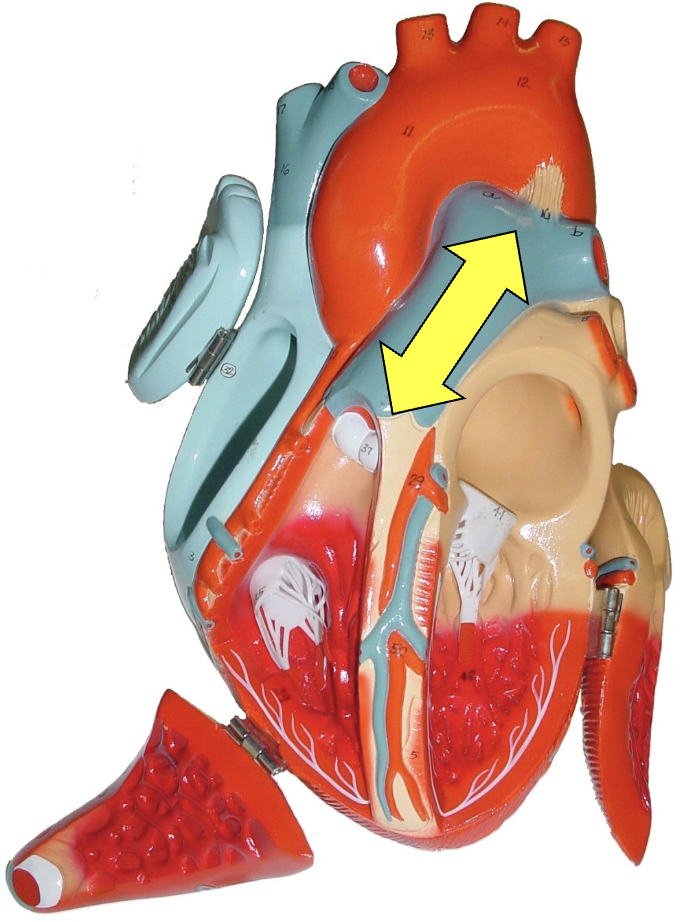 <p>what part of the heart muscle is shown?</p>