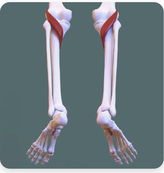 <p>O: Lateral femoral epicondyle</p><p>I: Proximal, posterior tibia</p><p>A: Flexion of the leg; internal rotation of the leg - “unlocks the knee”</p><p>N: Tibial nerve</p>
