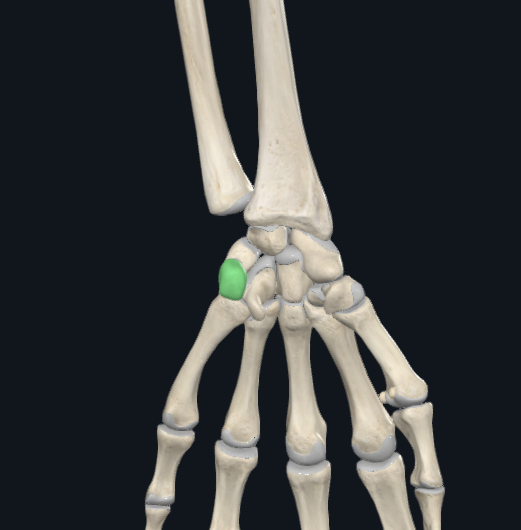 <p>what is this following bone and what section of the hand is it found in?</p>