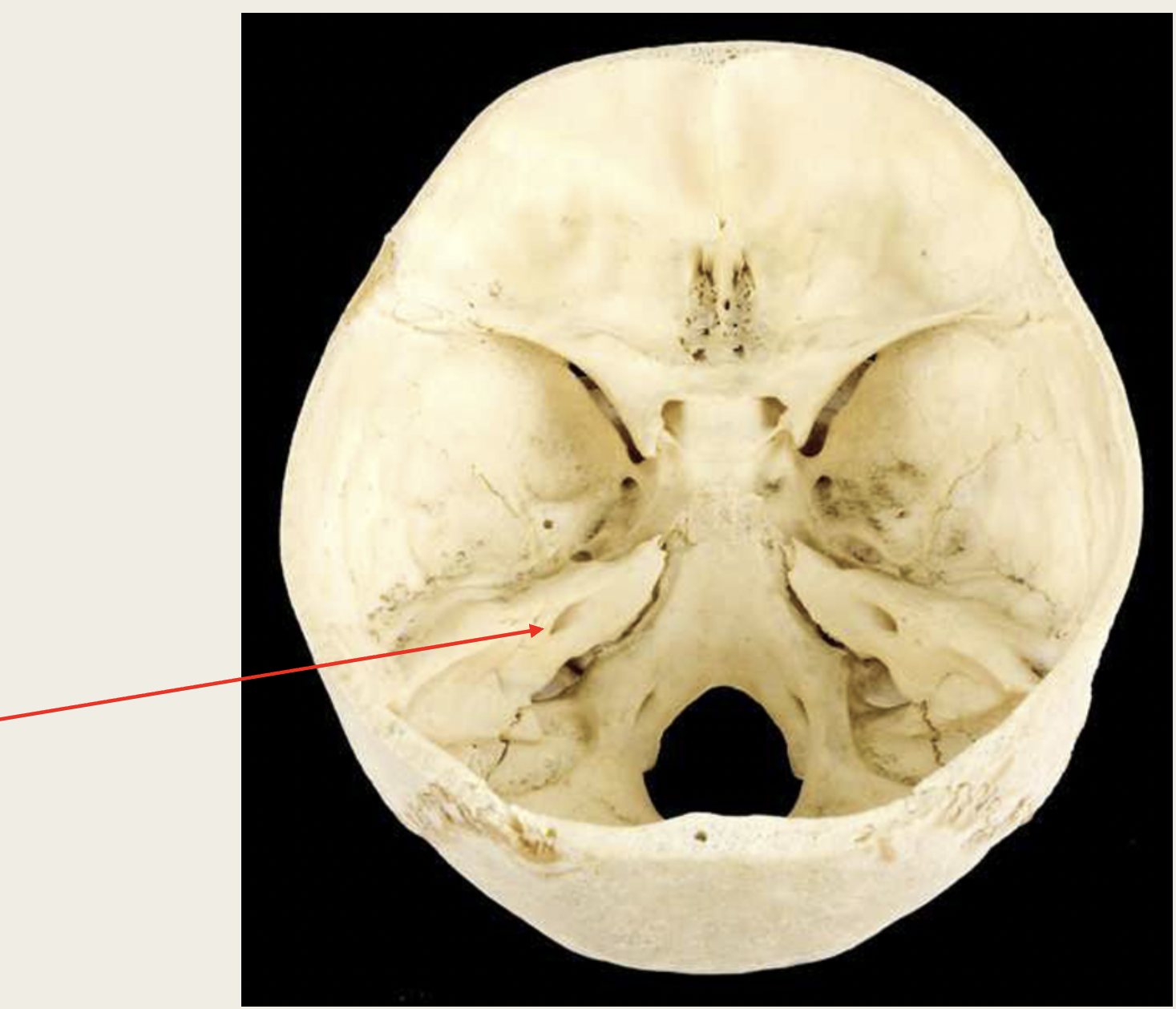 <p>Facial</p><p>Nerve (VII)</p><p>■ Function: Receives</p><p>XX information</p><p>from XX and controls</p><p>XX XX for  XX XX (both</p><p>XX &amp; XX)</p><p>■ Passes through XX XX XX</p>
