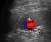 <p>Identify this image. </p>