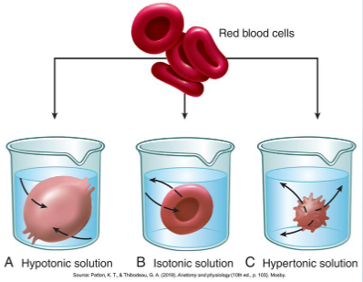 <p>Tonicity</p><p>more solute in cell causes more water to go in- hypotonic (think LOW conc OUTSIDE cell)</p><p>less sulute in cell causes water to leave- hypertonic (think HIGH conc OUTSIDE cell)</p><p>isotonic: normal saline or lactated ringers, mirrors composition of blood to avoid cells shrinking or swelling</p>