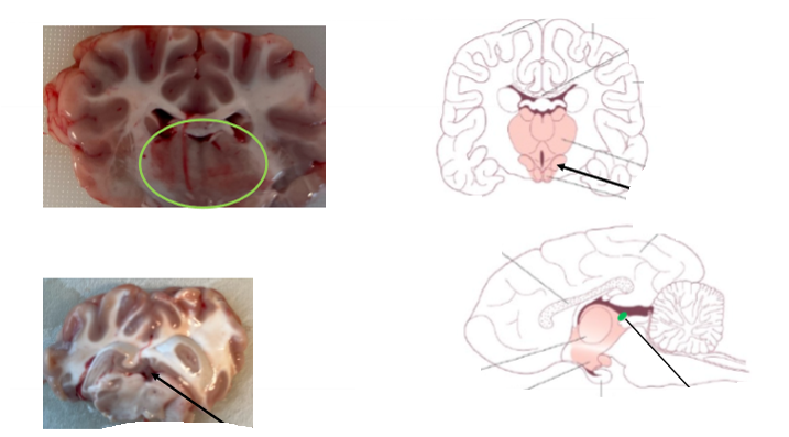 <p>Diencephalon - Mellanhjärnan.<br>Övre streck över övre pil</p>