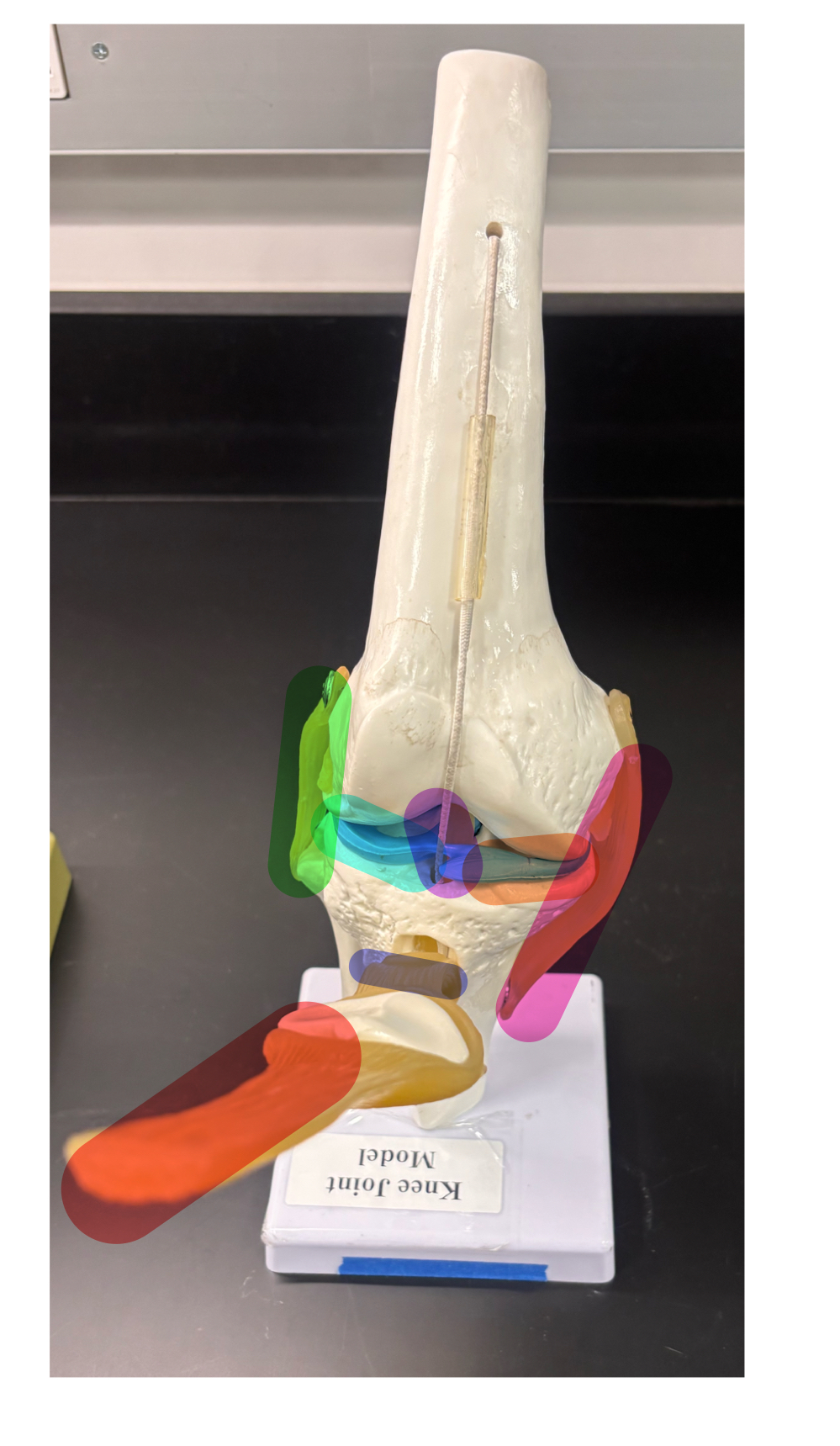 <p>name the tendon that’s highlighted red</p>